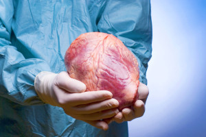 transplant de inima