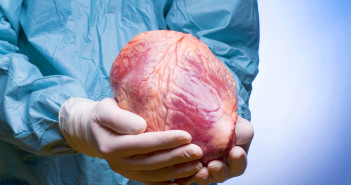 transplant de inima