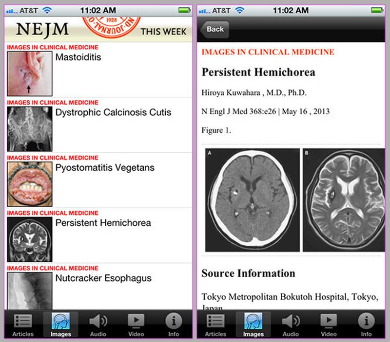 NEJM-This-Week